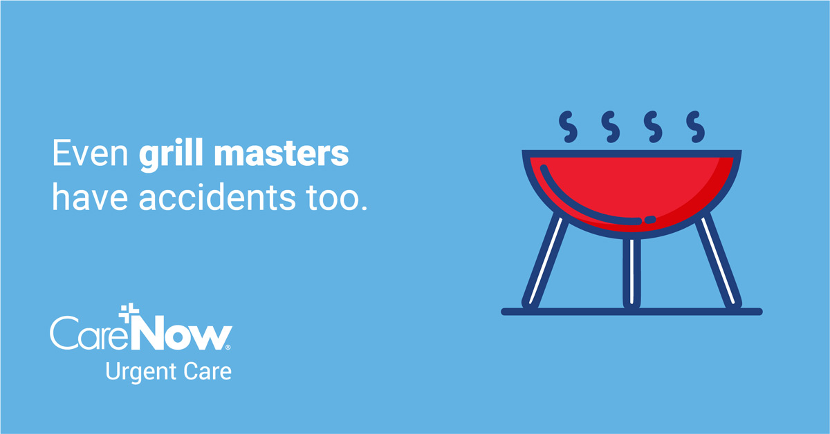 Even grill masters have accidents too - CareNow Urgent Care